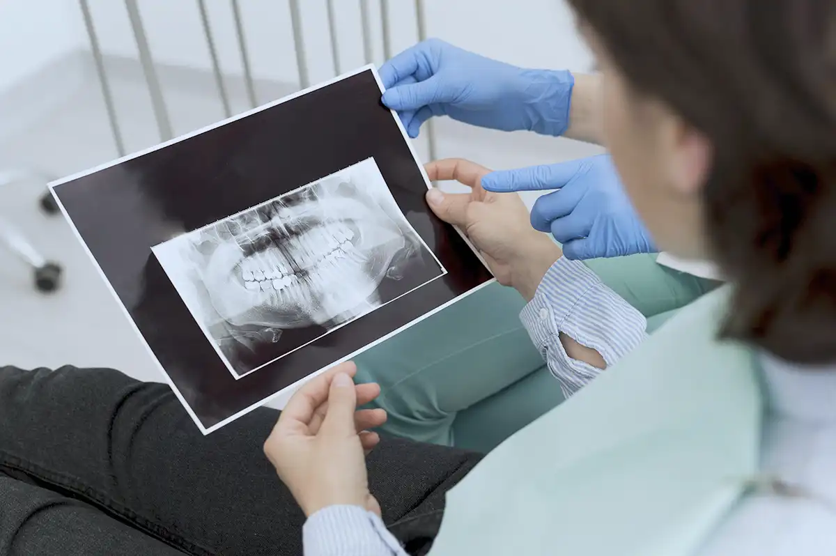 Implantes dentales